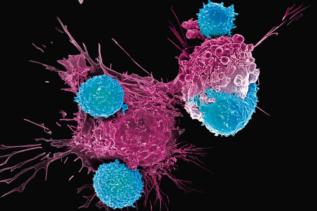 CAR T cell therapy