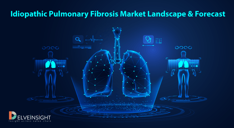 Idiopathic Pulmonary Fibrosis Market