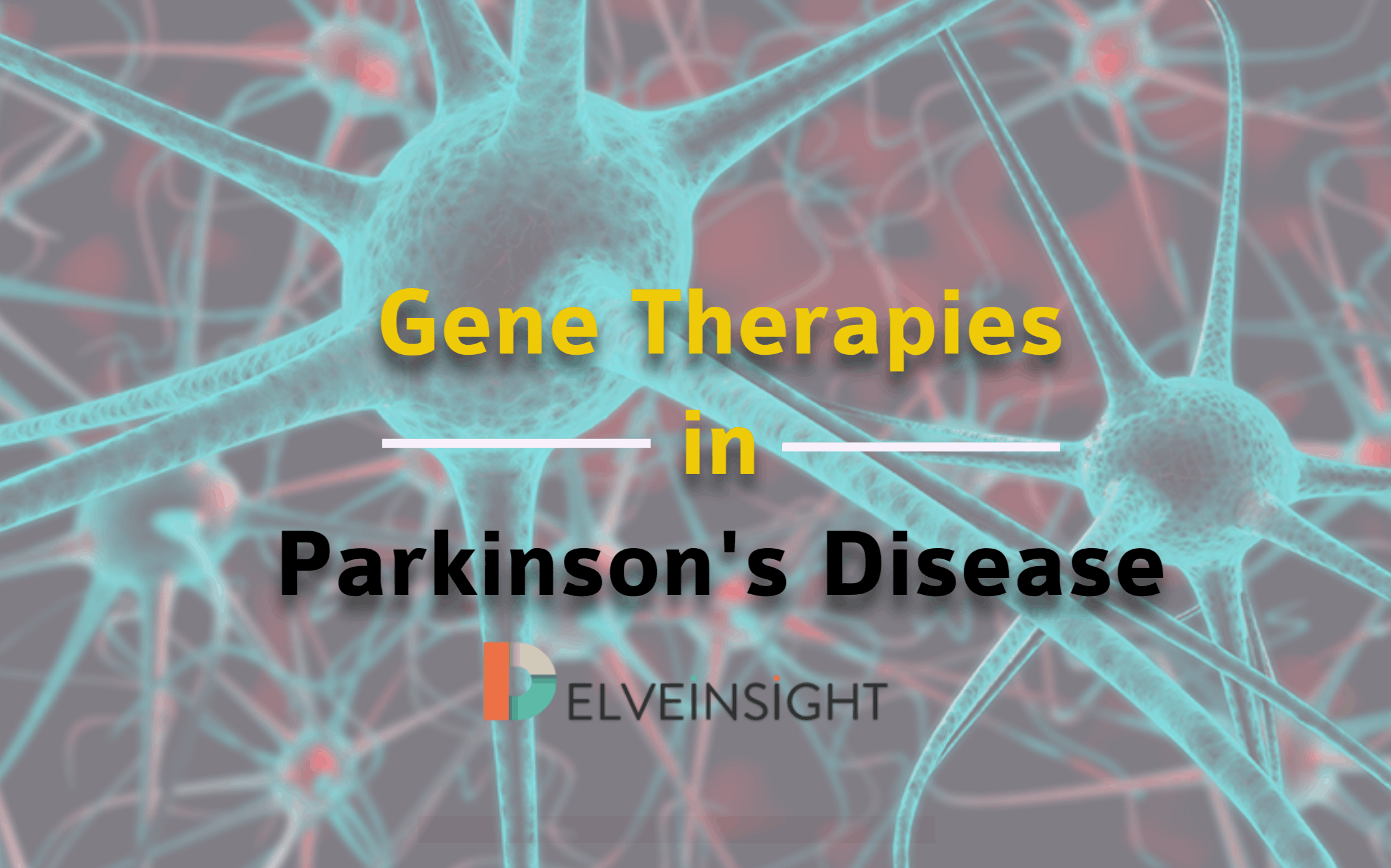 Parkinson’s disease