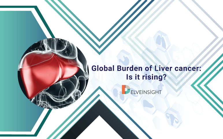 Global Liver Cancer Incidence