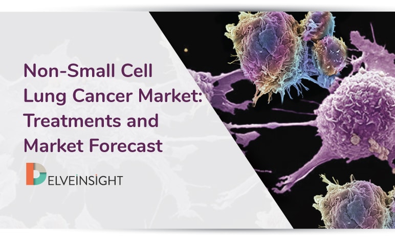Non-Small Cell Lung Cancer Market