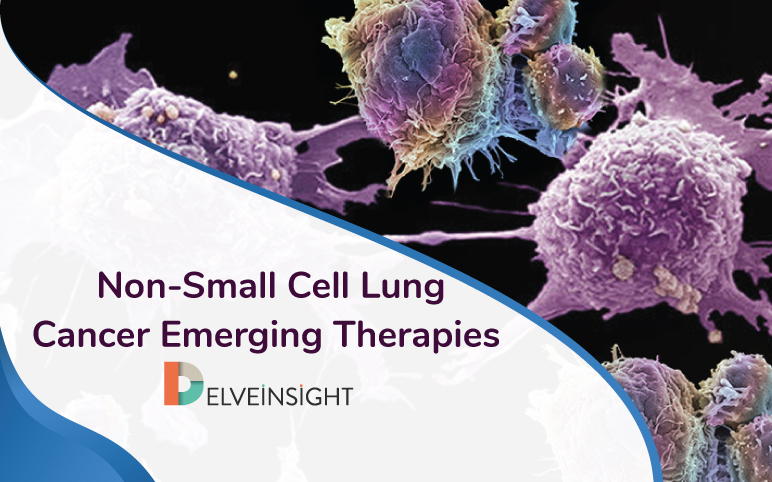 Non-small cell lung cancer emerging therapies