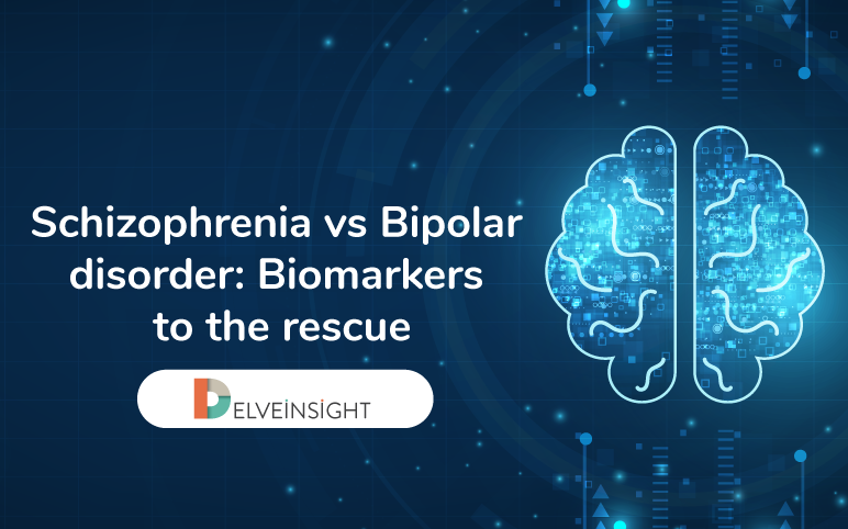 Schizophrenia vs Bipolar disorder: Biomarkers to the rescue