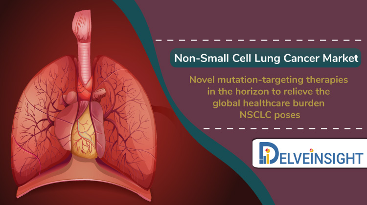 Non-Small Cell Lung Cancer Market Insights