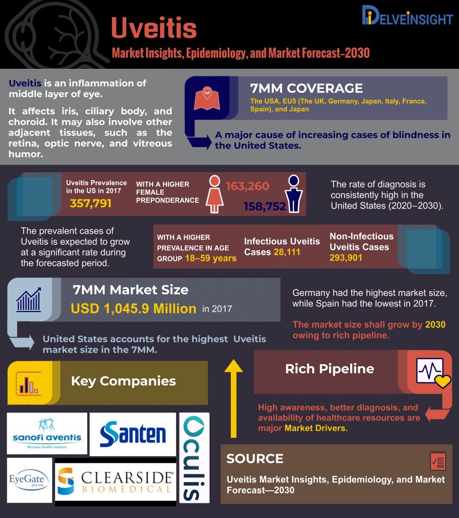 Uveitis Market