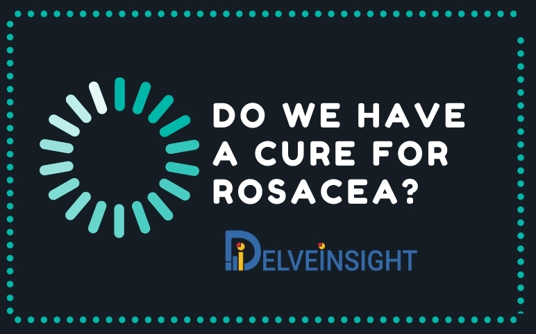 Rosacea Treatment Market | Rosacea Pipeline Therapies