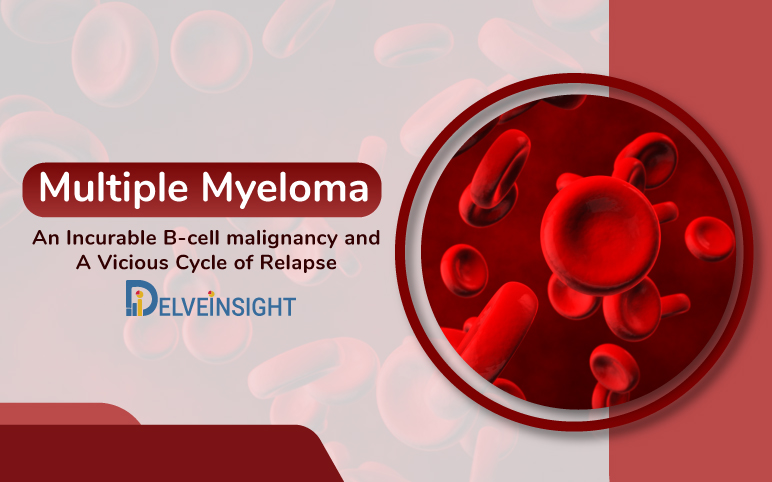 Multiple Myeloma: An Incurable B-cell malignancy and A Vicious Cycle of Relapse