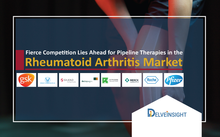 Rheumatoid arthritis market | Rheumatoid arthritis treatment market | Rheumatoid arthritis market | Rheumatoid arthritis drug pipeline