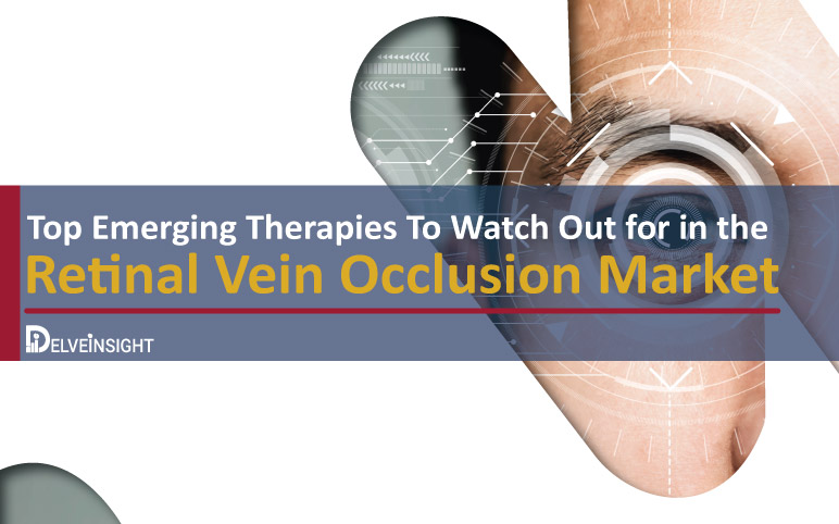 Retinal Vein Occlusion Market | Retinal Vein Occlusion Market Emerging Therapies | Retinal Vein Occlusion Market Pharma companies