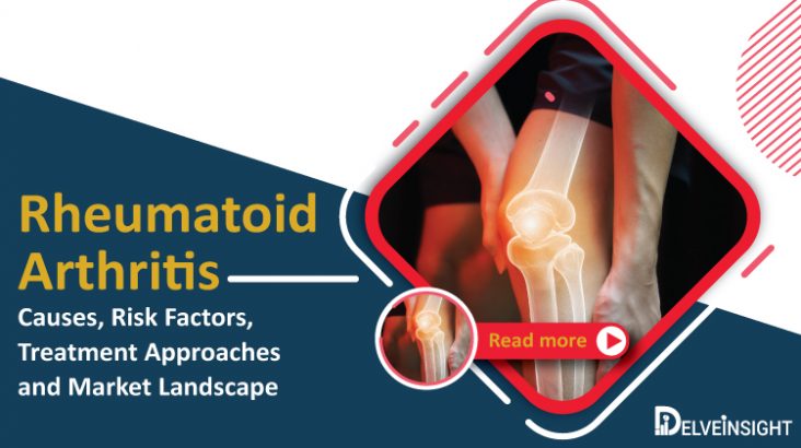 rheumatoid-arthritis-sign-symptoms-epidemiology-causes-risk-factors-treatment-approaches-and-market-landscape