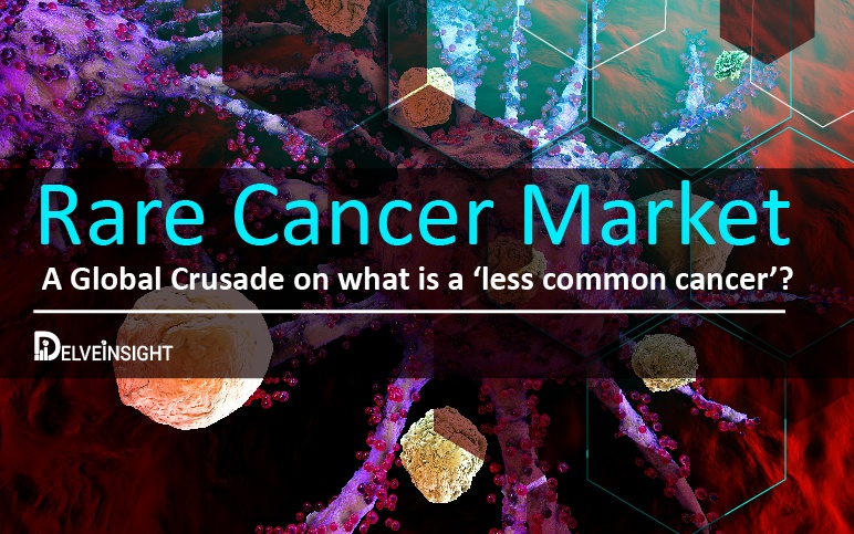 Rare Cancer Market | Soft Tissue Sarcoma Market | Multiple Myeloma Market | Glioblastoma Multiforme Market | Cholangiocarcinoma Market | Synovial Sarcoma Market