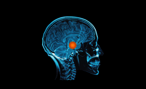 GBM-Market-Glioblastoma-Multiforme-Therapeutic-Advancements