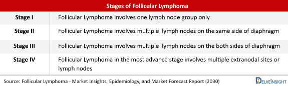 Stages-of-Follicular-Lymphoma