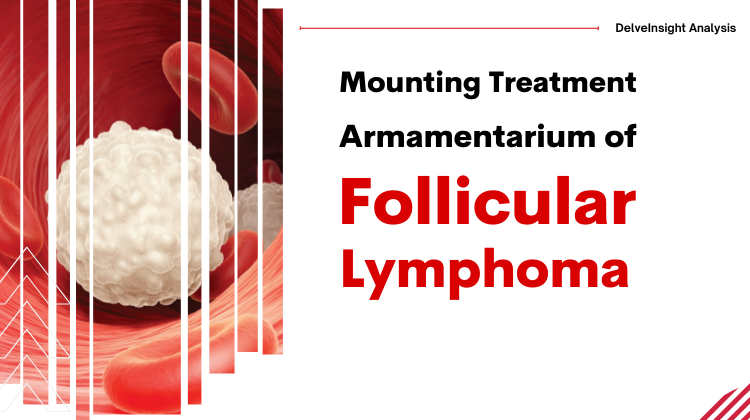 follicular-lymphoma-treatment-scenario