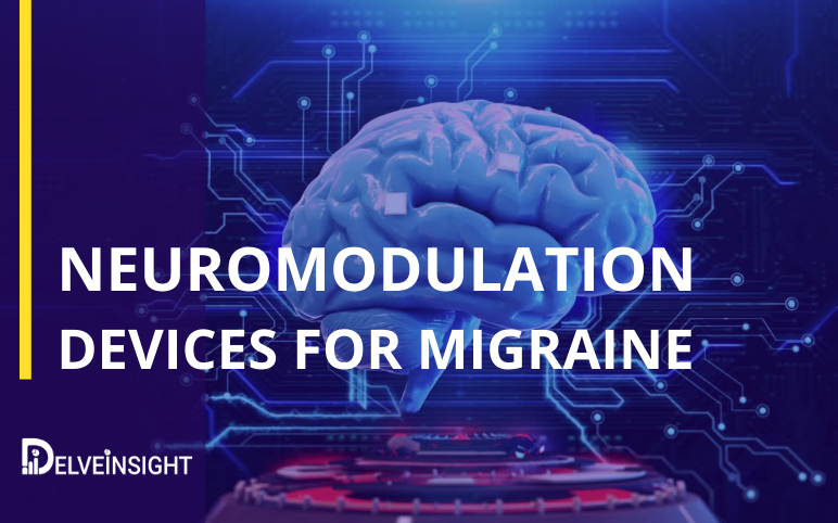 Neuromodulation-Devices-Migraine