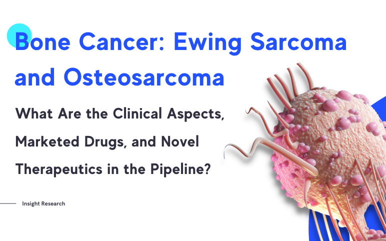 Ewing-sarcoma-and-osteosarcoma