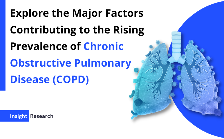 Chronic Obstructive Pulmonary Disease Epidemiology Insights