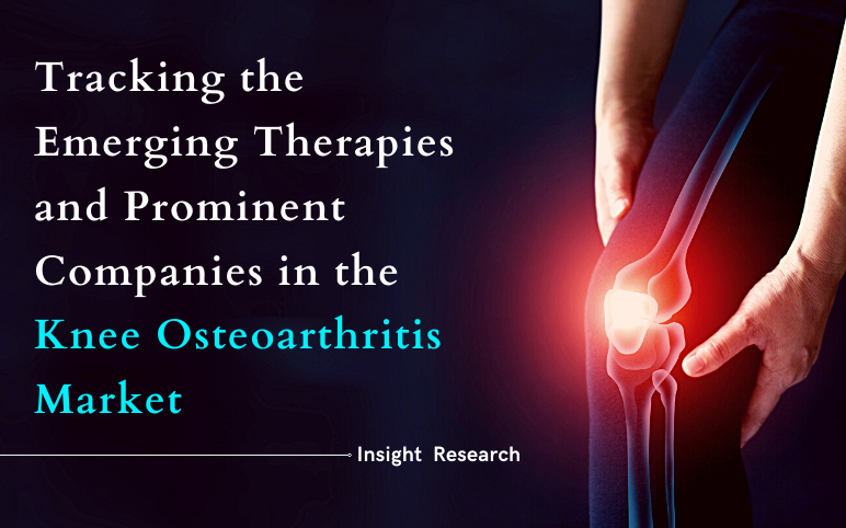 Emerging Therapies and Key Companies in the Knee Osteoarthritis Market