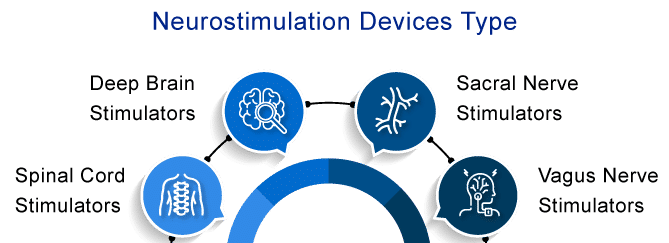 Major Types of Neurostimulation-Devices in the Market