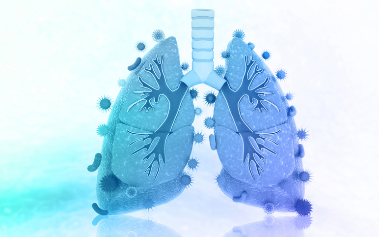 Rising Acute Respiratory Distress Syndrome (ARDS) Prevalence Posing a Major Public Health Concern