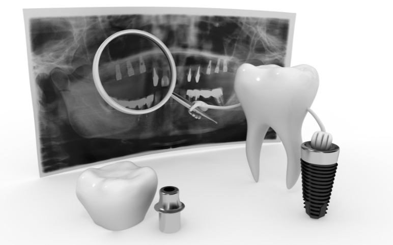 Emerging Trends and Technologies in the Dental Care Market