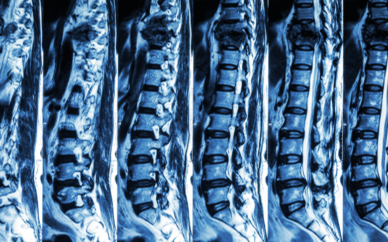 Spinal Cord Injury Rehabilitation Technology and Trends