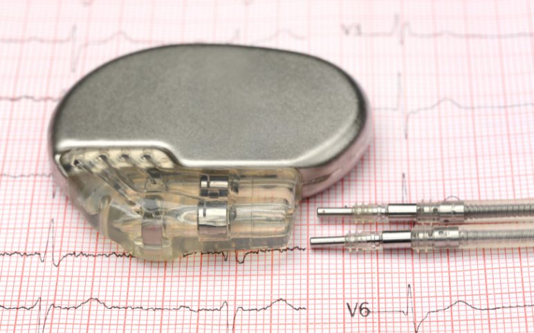 Pacemakers Market and Assessment of Trends, Developments, Growth