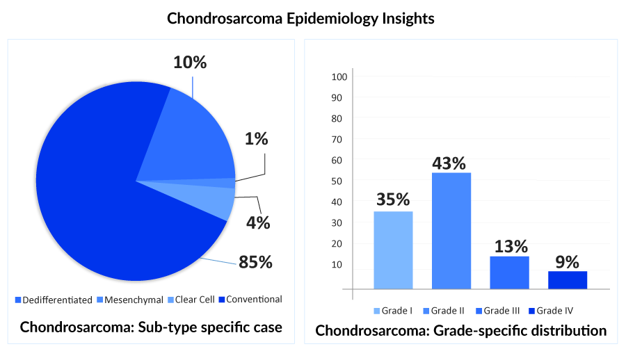 Chondrosarcoma Epidemiology Insights