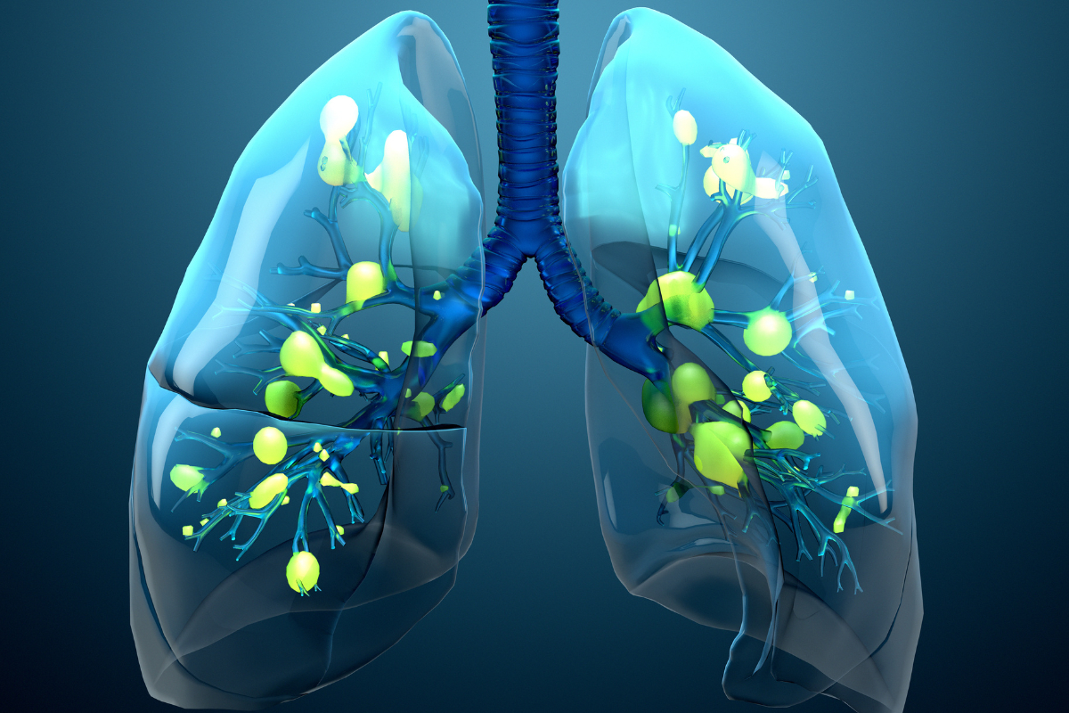 Chronic Obstructive Pulmonary Disease (COPD) Market Outlook