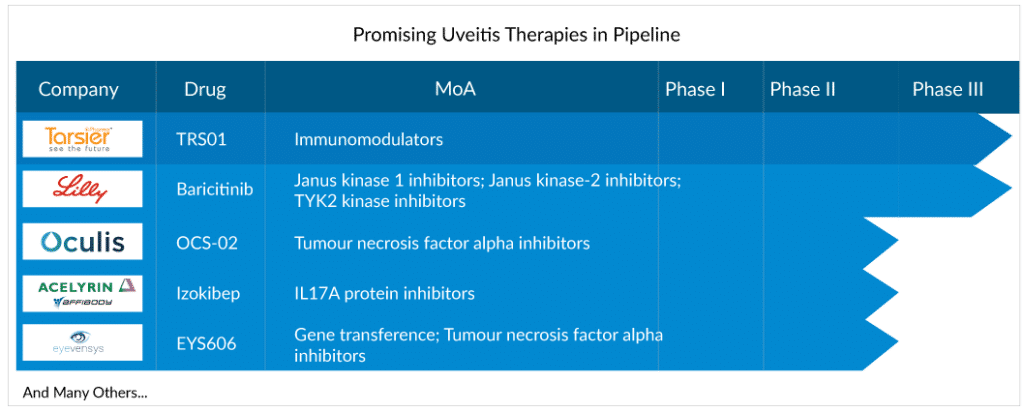 Promising Uveitis Therapies in Pipeline