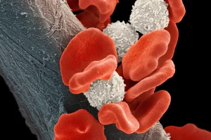 bispecific-antibodies-for-multiple-myeloma-treatment