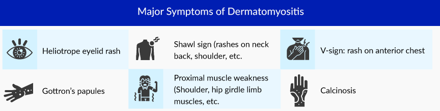 Major Symptoms of Dermatomyositis