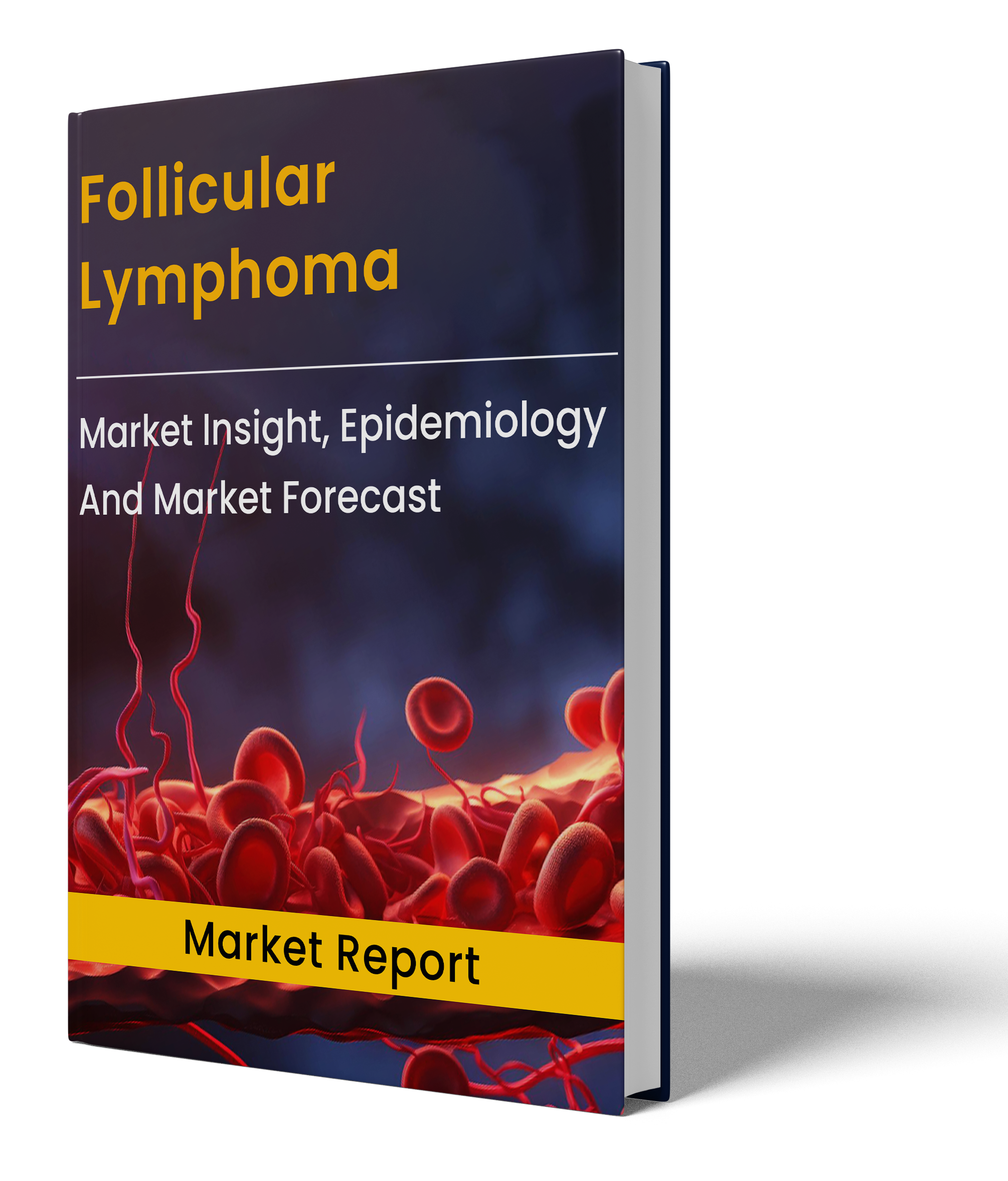 Follicular Lymphoma Market Report