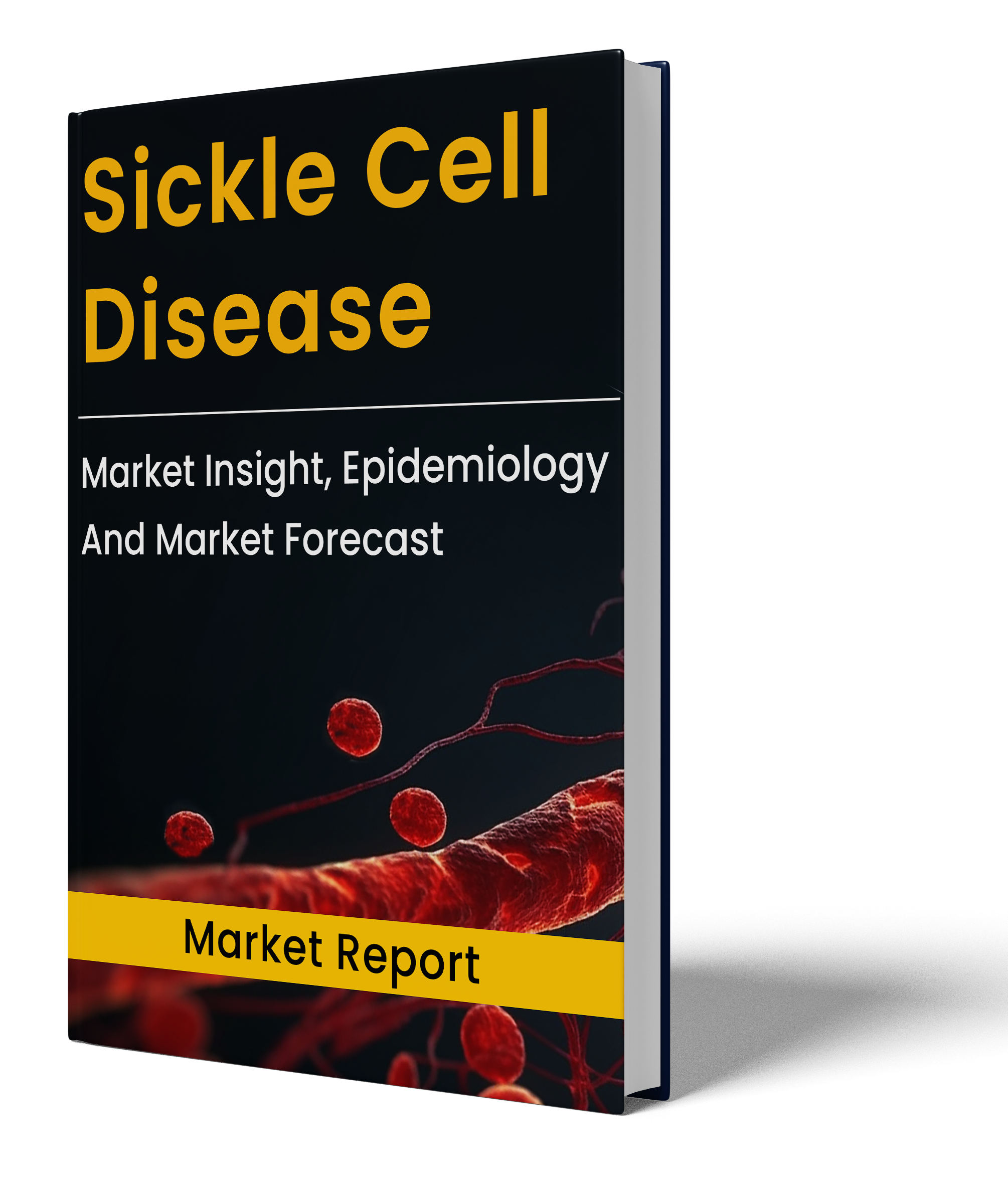 Sickle Cell Disease Market Report