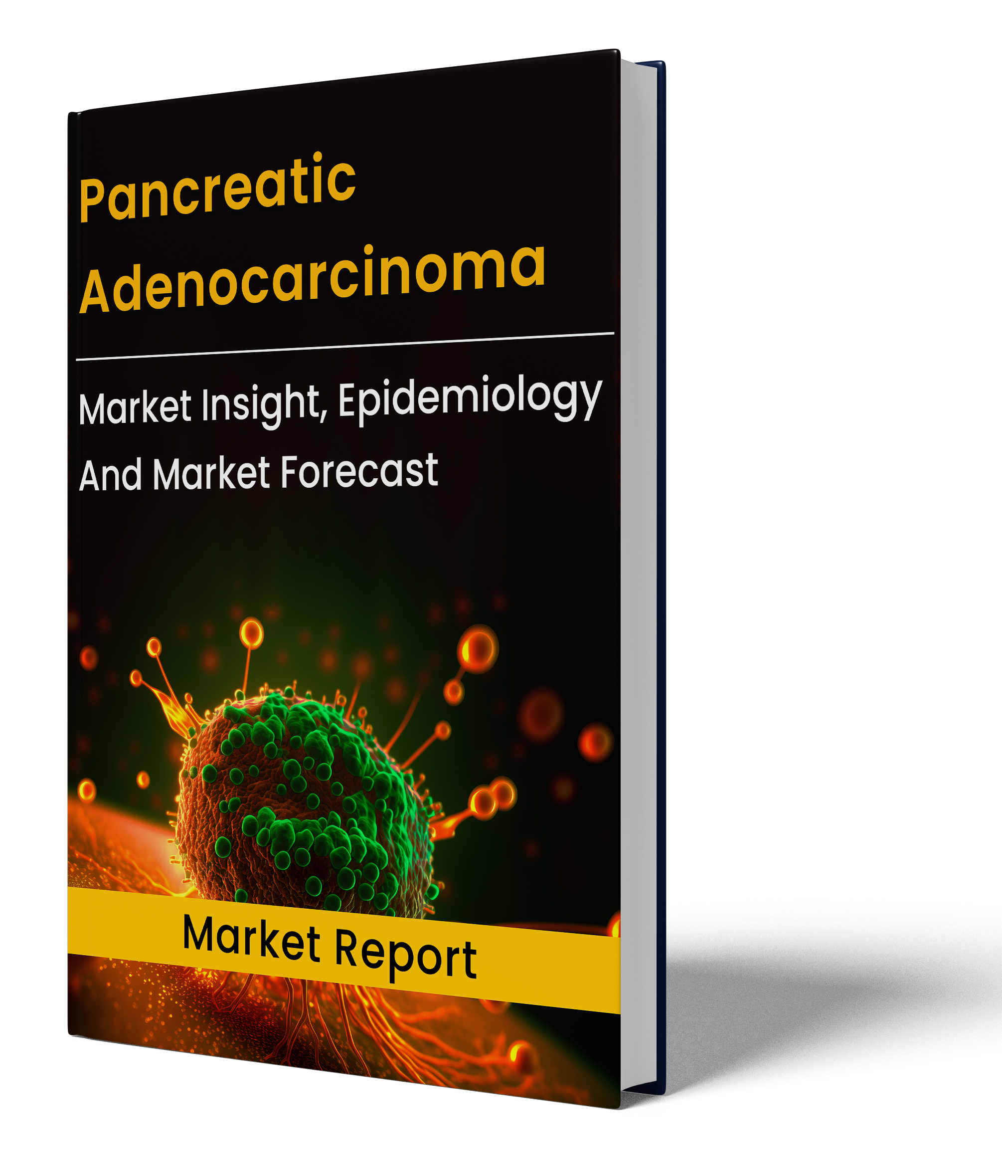 Pancreatic Adenocarcinoma market report