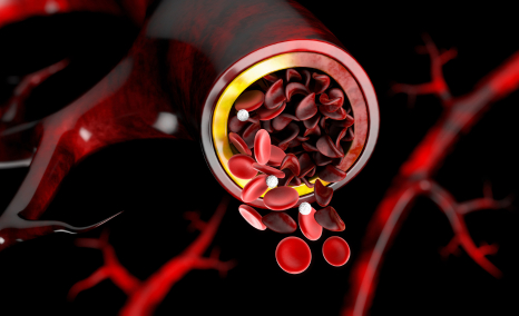 insights-into-artificial-blood-vessels
