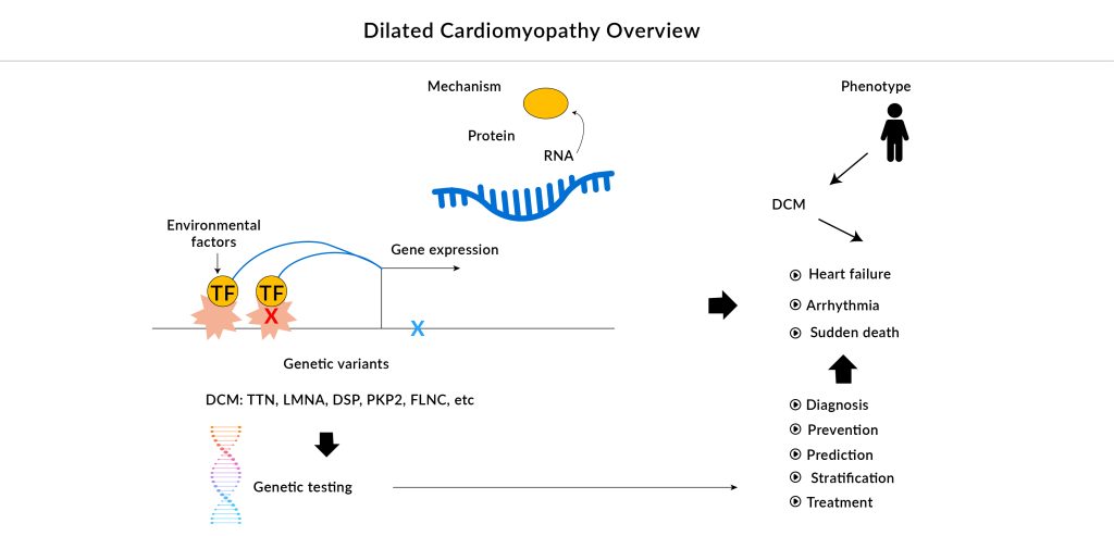 Dilated Cardiomyopathy Overview