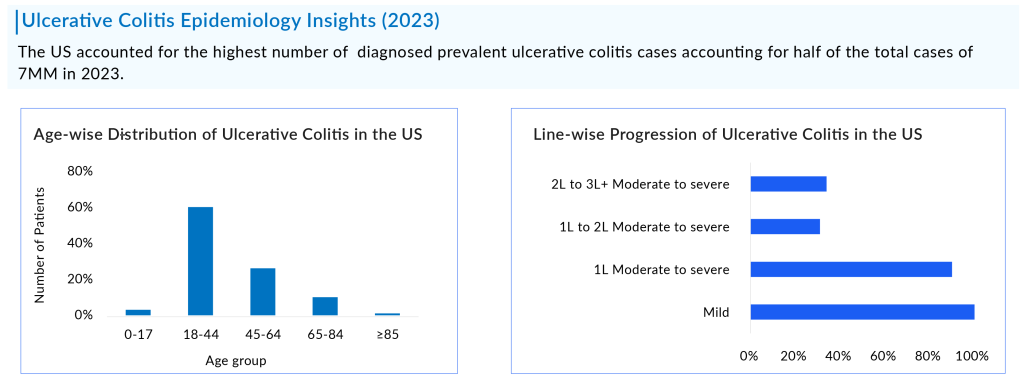 Ulcerative Colitis Epidemiology Insights