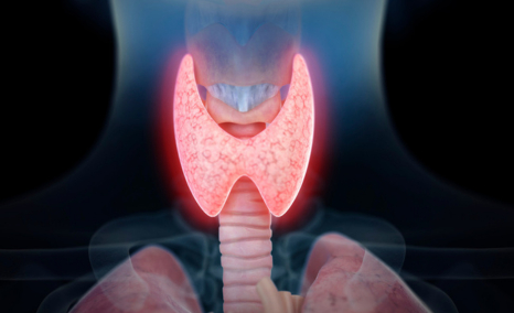 hashimotos-thyroiditis-treatment-landscape