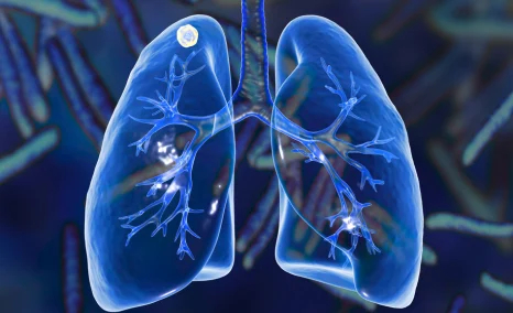 dupixents-launch-in-copd