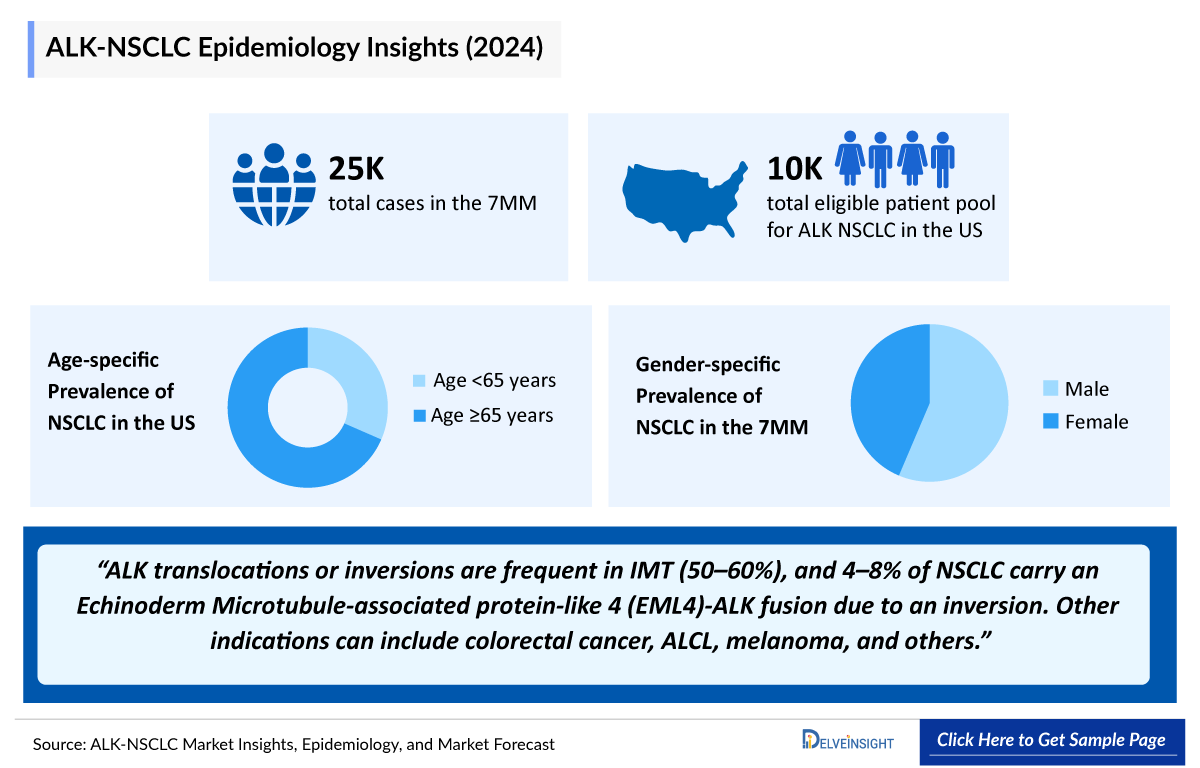 ALK NSCLC Epidemiology