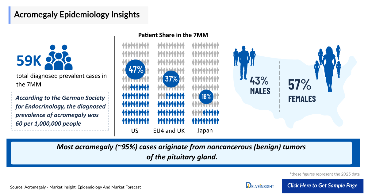 Acromegaly Epidemiology