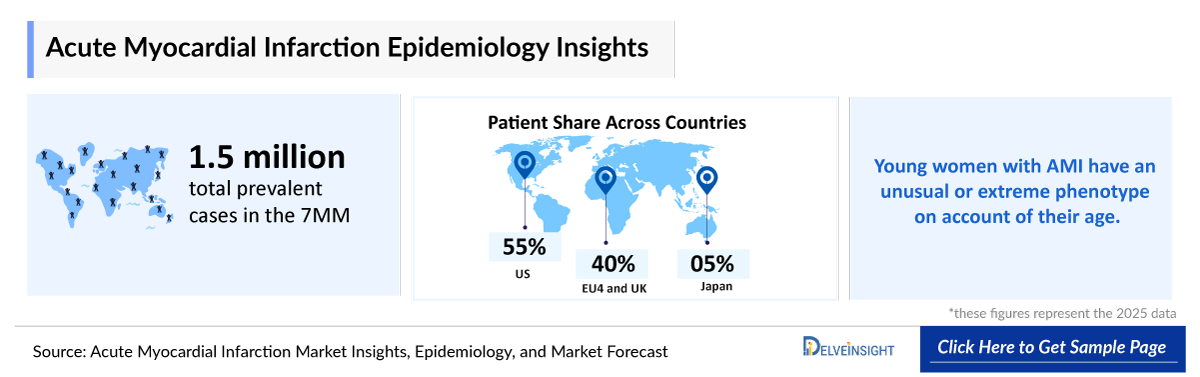 Acute Myocardial Infarction Epidemiology