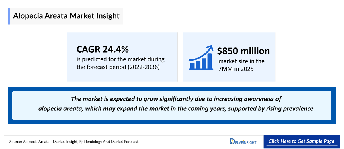 Alopecia Areata Market Outlook