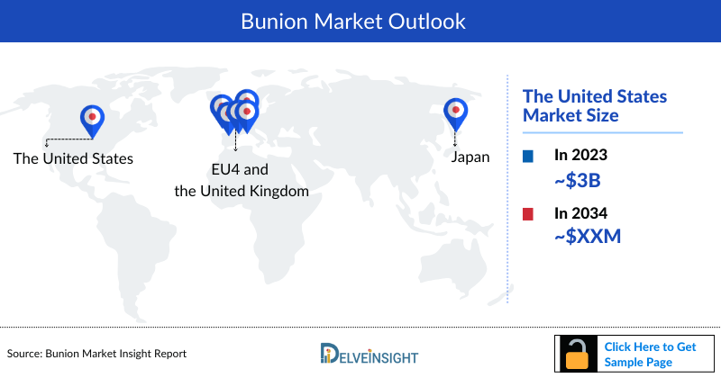 Bunion Market Outlook