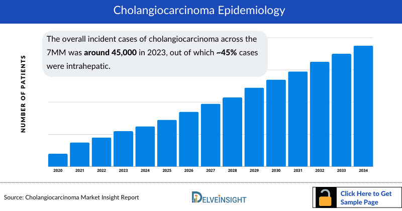 Cholangiocarcinoma Epidemiology