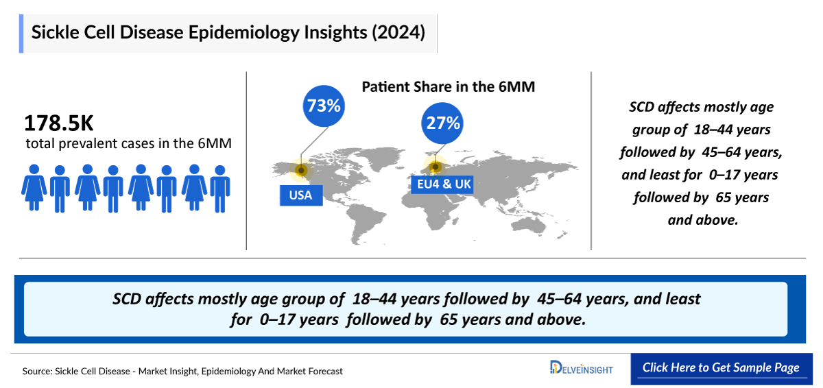 Sickle Cell Disease Epidemiology