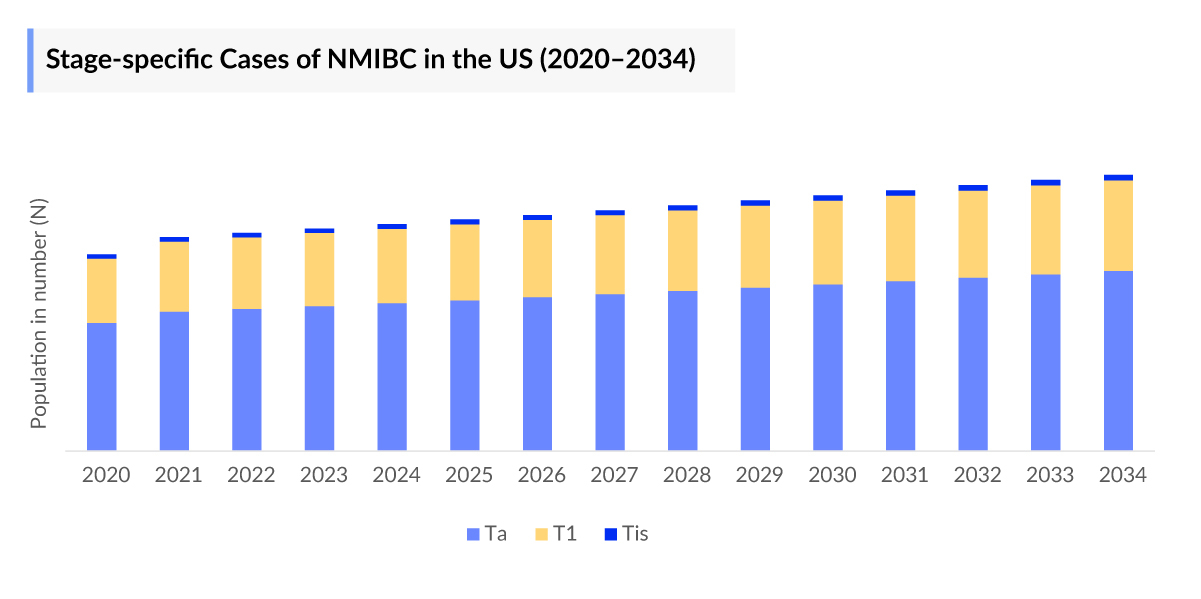 Non Muscle Invasive Bladder Cancer Stage-specific Cases