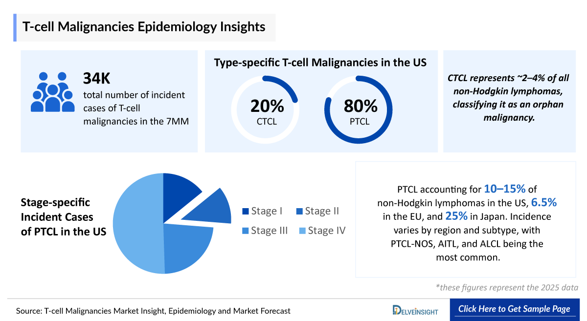 T-cell Malignancies Epidemiology