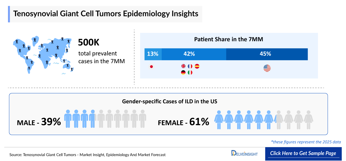 Tenosynovial Giant Cell Tumor Epidemiology